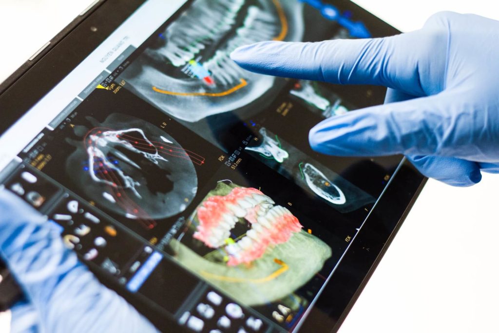 Digital Dentistry is Revolutionizing the Dental Industry and Patient Care