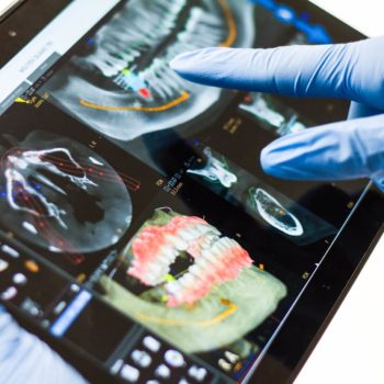 Digital Dentistry is Revolutionizing the Dental Industry and Patient Care with Advanced Technology